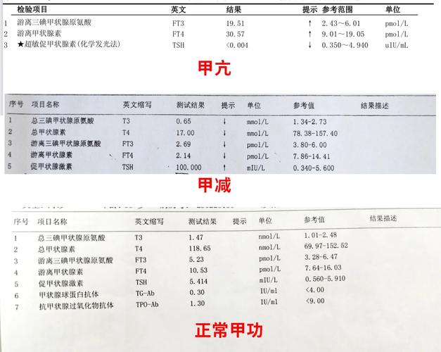 新生儿甲功三项正常值范围是多少？不同实验室标准是否存在差异？-第3张图片-郑州医学网