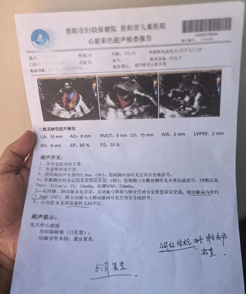 孕期心脏彩超到底该不该做？不做会有风险吗？医生会怎么建议？-第1张图片-郑州医学网