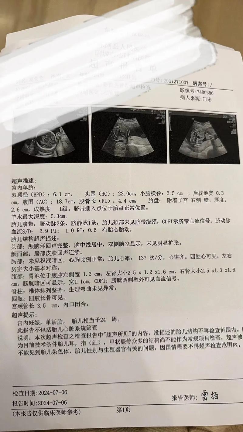 孕期心脏彩超到底该不该做？不做会有风险吗？医生会怎么建议？-第2张图片-郑州医学网