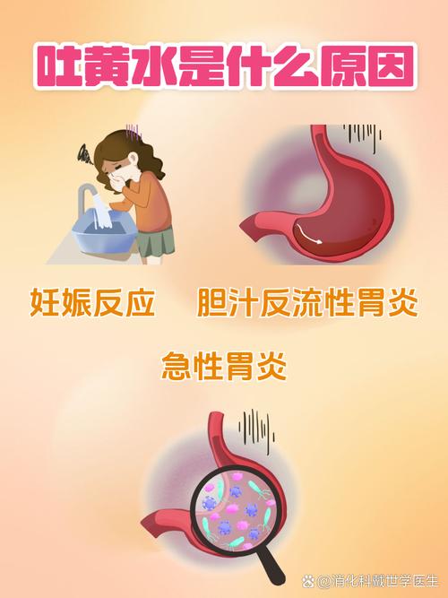 孕期吐黄水是胆汁反流还是肝胆异常？需警惕哪些健康风险？-第1张图片-郑州医学网