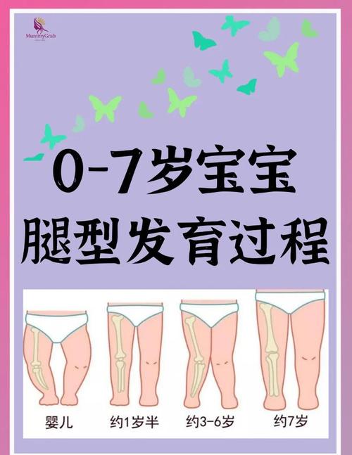 新生儿左右腿不一样粗是正常现象还是发育异常？需要警惕哪些潜在问题？-第3张图片-郑州医学网