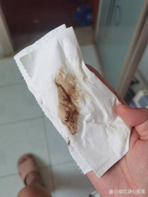 有没有孕期一直流褐色-第1张图片-郑州医学网 有没有孕期一直流褐色-第1张图片-郑州医学网