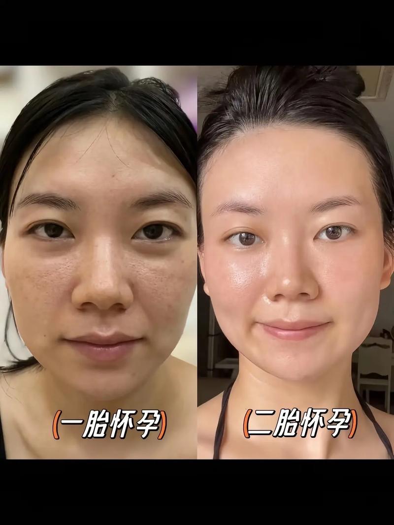 孕期不小心吃到护肤品-第1张图片-郑州医学网