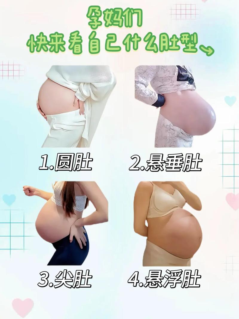 孕期几个月肚脐眼突出是正常现象吗？需要干预吗？-第2张图片-郑州医学网