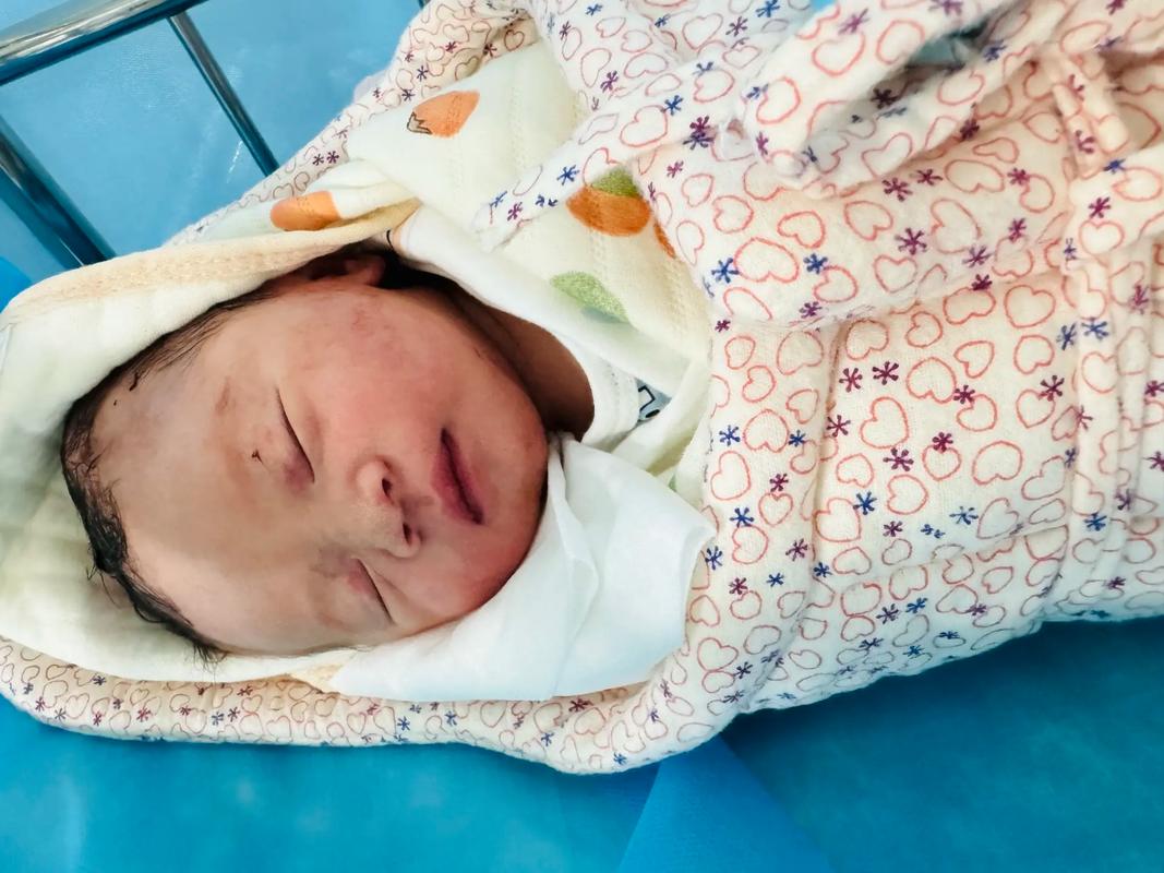 新生儿刚出生就有眼泪，是正常生理现象还是健康预警信号？-第3张图片-郑州医学网