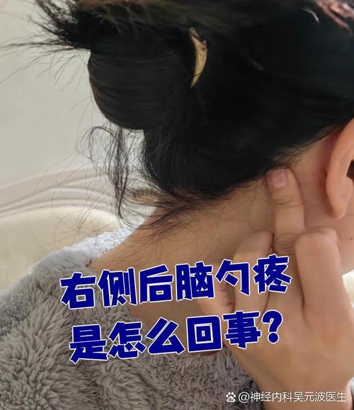 孕期睡醒后脑勺疼,是睡姿不对还是身体在报警?-第2张图片-郑州医学网 孕期睡醒后脑勺疼,是睡姿不对还是身体在报警?-第2张图片-郑州医学网