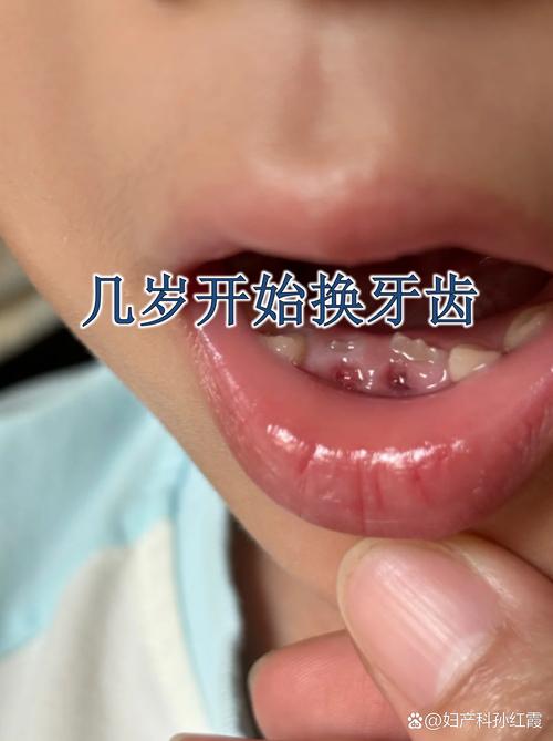 儿童换牙期补钙真的有必要吗?补钙过多或不足会有哪些影响?-第3张图片-郑州医学网 儿童换牙期补钙真的有必要吗?补钙过多或不足会有哪些影响?-第3张图片-郑州医学网