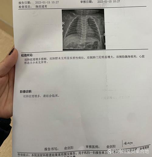 儿童双肺纹理增重模糊是肺炎吗?需要做哪些检查?-第1张图片-郑州医学网 儿童双肺纹理增重模糊是肺炎吗?需要做哪些检查?-第1张图片-郑州医学网