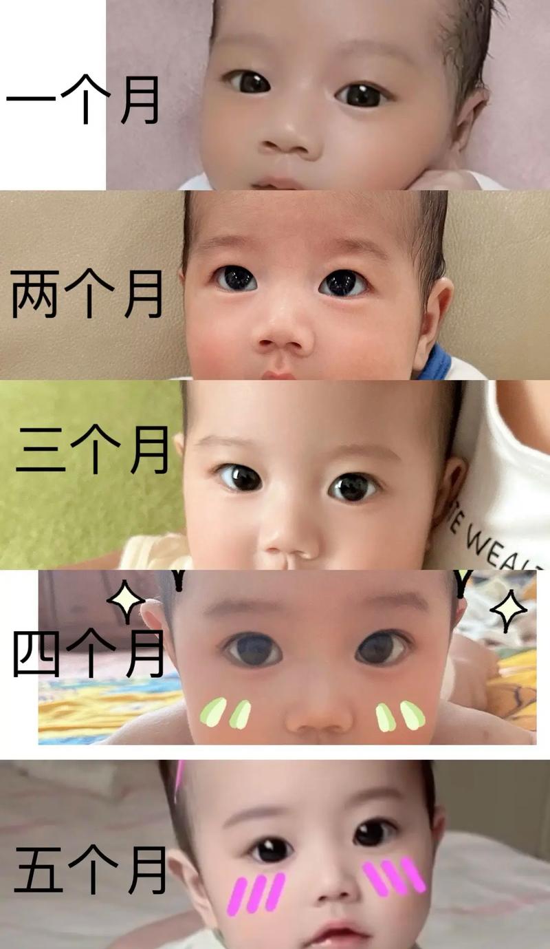 新生儿几个月会变成双眼皮？是自然变化还是与后天因素有关？-第2张图片-郑州医学网