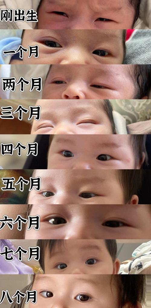 新生儿几个月会变成双眼皮？是自然变化还是与后天因素有关？-第1张图片-郑州医学网
