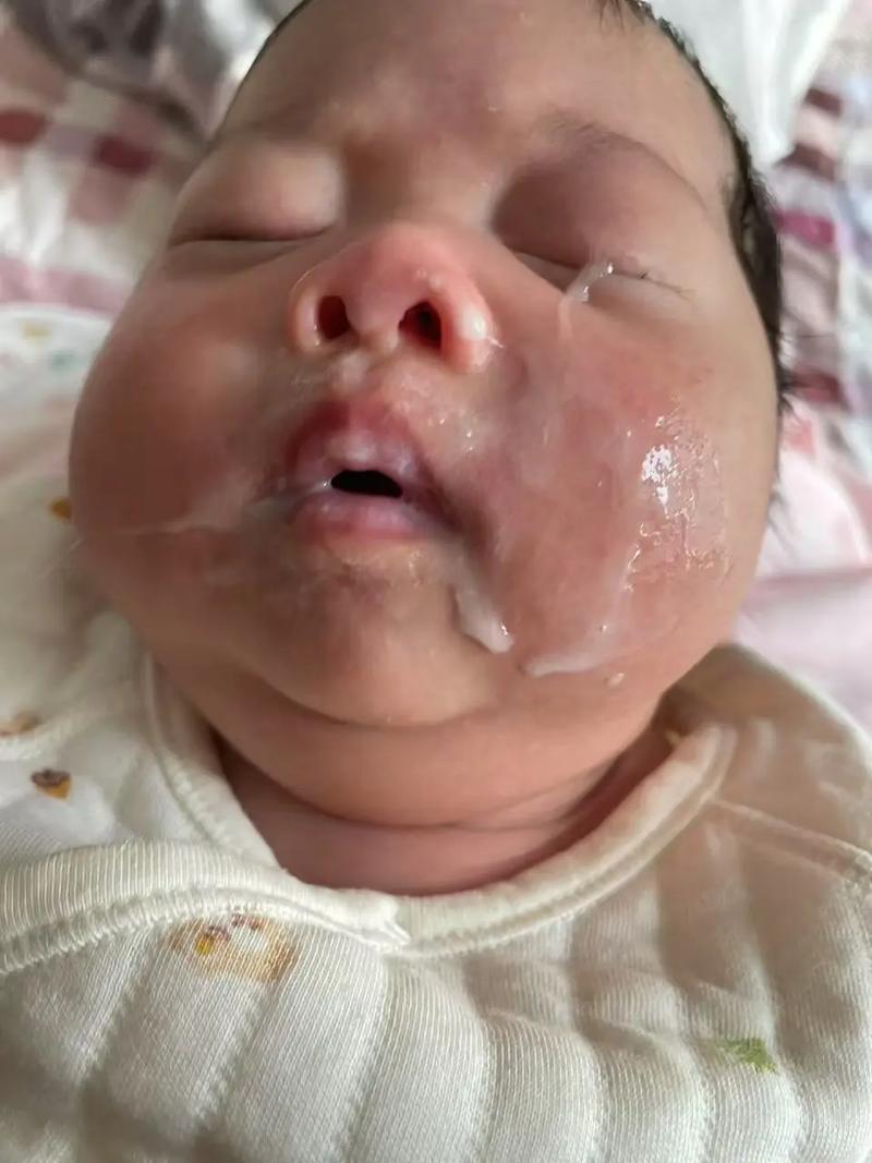 新生儿想吐奶却吐不出来，是消化问题还是身体异常信号？-第1张图片-郑州医学网