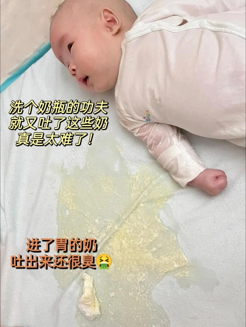 新生儿想吐奶却吐不出来，是消化问题还是身体异常信号？-第2张图片-郑州医学网