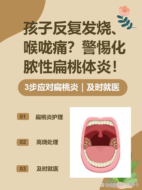 儿童嗓子化脓发烧一般几天能退烧？如何判断是否需要就医？-第1张图片-郑州医学网