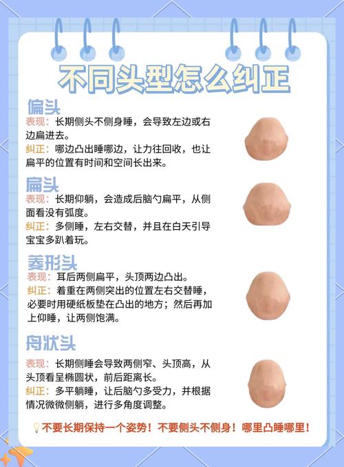 新生儿头尖尖的怎么办-第1张图片-郑州医学网