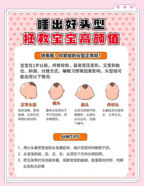 新生儿头尖尖的怎么办-第3张图片-郑州医学网