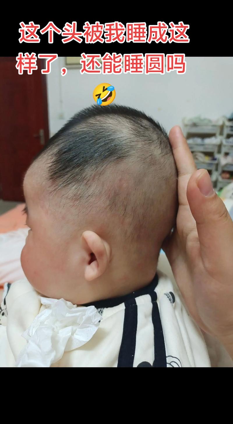 新生儿头尖尖的怎么办-第2张图片-郑州医学网