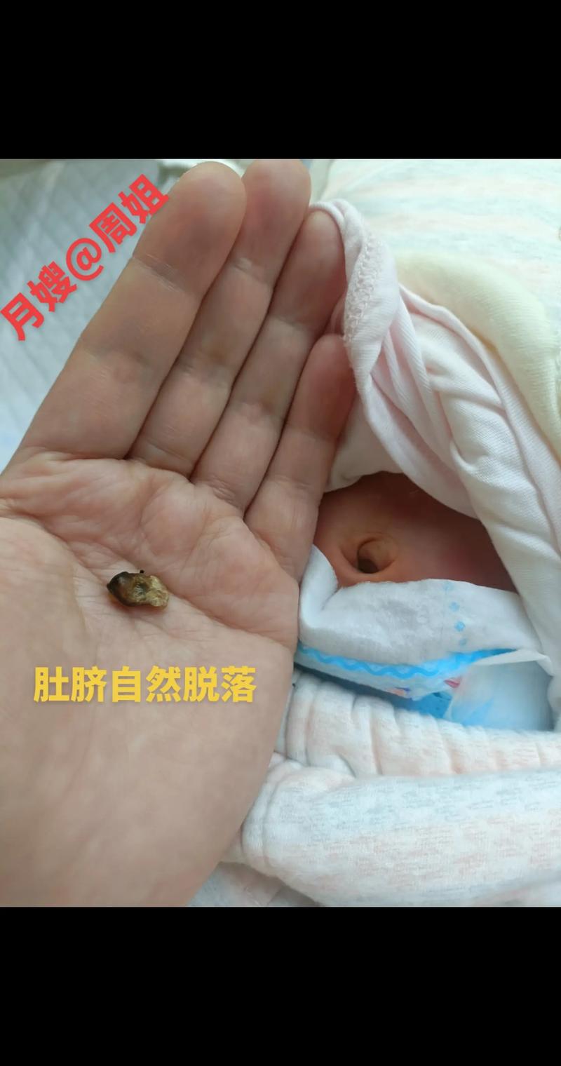 新生儿一般多久能聚肚?是正常发育信号还是需警惕的异常表现?-第2张图片-郑州医学网 新生儿一般多久能聚肚?是正常发育信号还是需警惕的异常表现?-第2张图片-郑州医学网