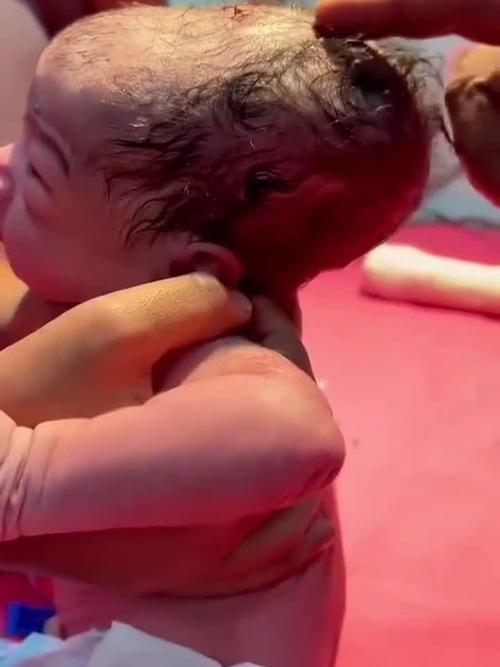 新生儿出生就会转头，是天生的本能还是后天习得的技能？-第2张图片-郑州医学网