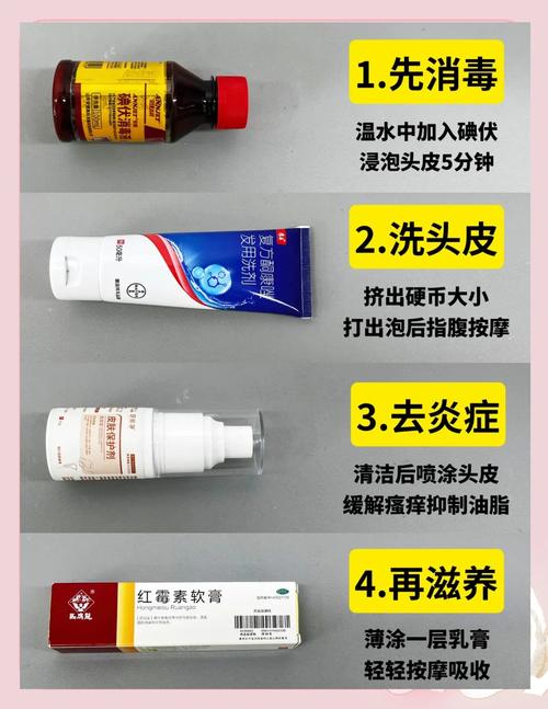 儿童头皮屑频发，是湿疹还是脂溢性皮炎？日常护理该如何正确处理？-第2张图片-郑州医学网