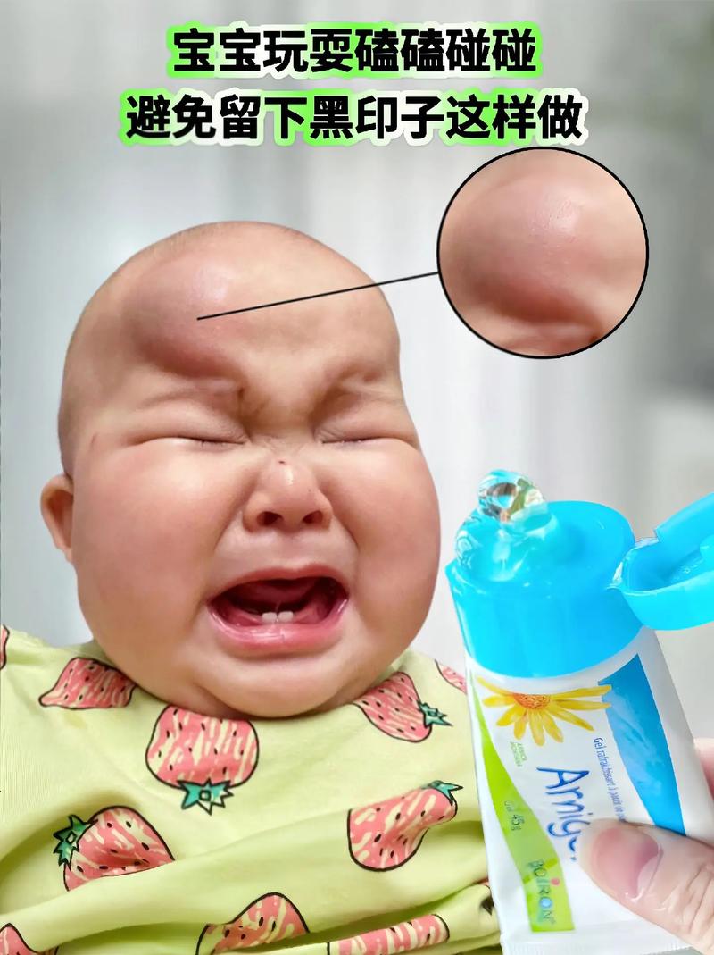 新生儿头部被砸后，家长该如何判断是否需要就医？有哪些异常症状需警惕？-第2张图片-郑州医学网