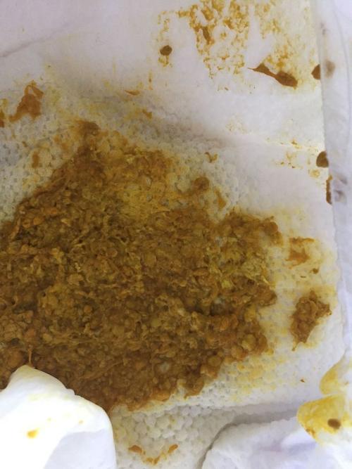 新生儿大便呈一粒粒状是正常还是异常？需要警惕哪些健康问题？-第2张图片-郑州医学网