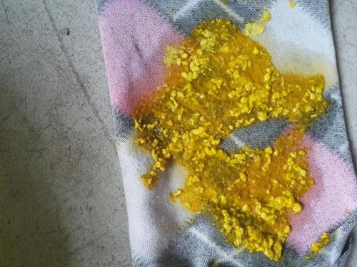 新生儿大便呈一粒粒状是正常还是异常?需要警惕哪些健康问题?-第3张图片-郑州医学网 新生儿大便呈一粒粒状是正常还是异常?需要警惕哪些健康问题?-第3张图片-郑州医学网