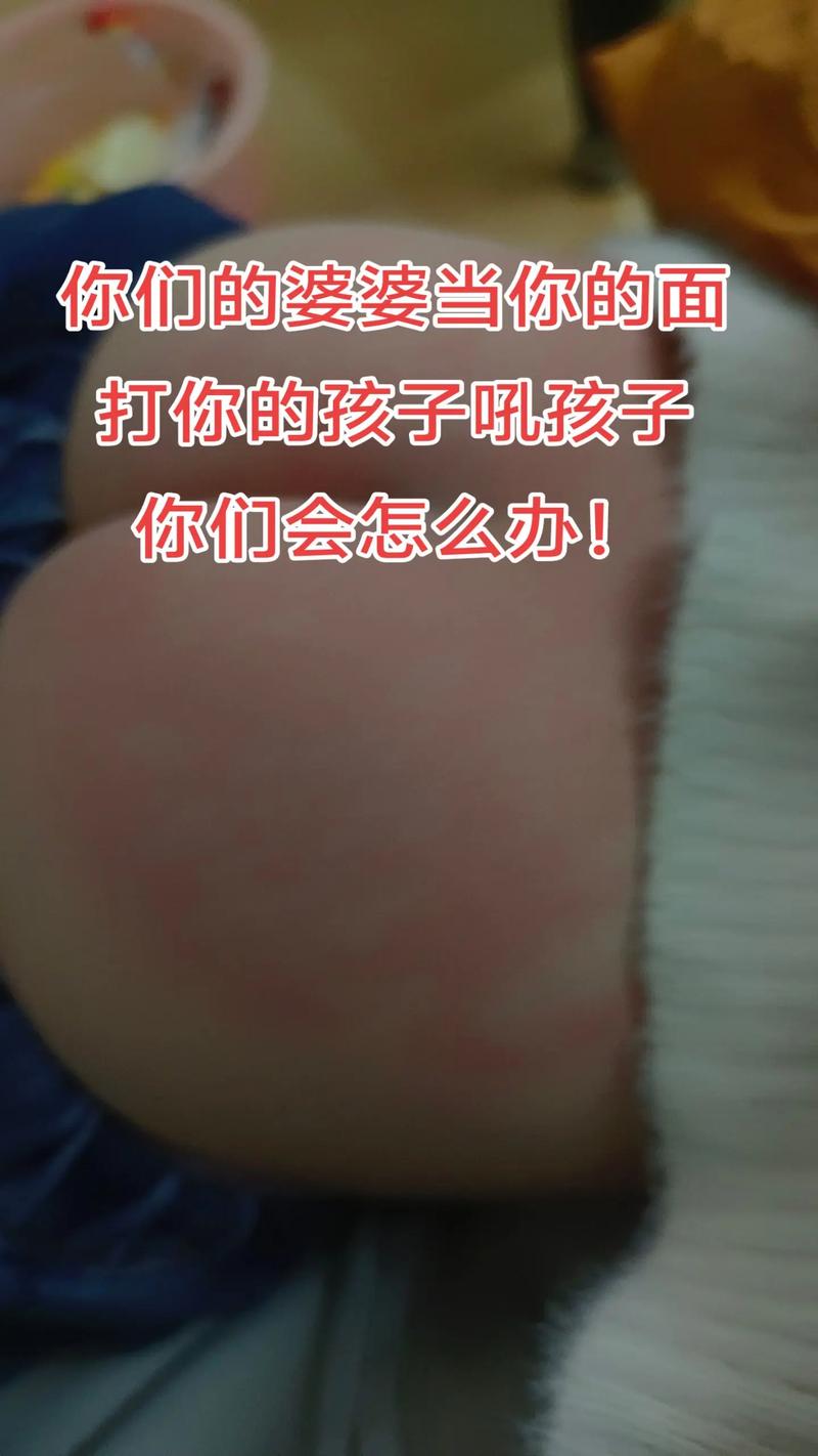 孕期被小孩子打到肚子，会对胎儿造成什么影响？需要立即就医吗？-第2张图片-郑州医学网