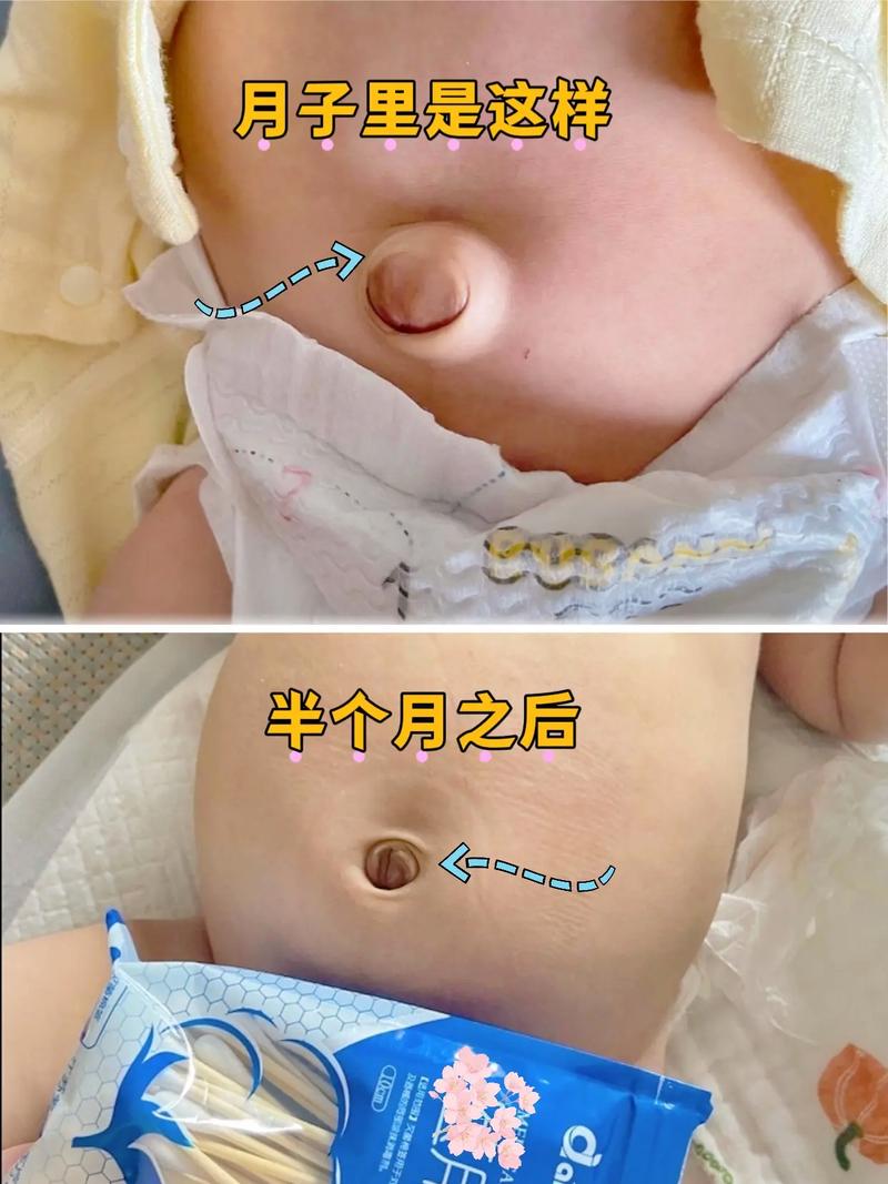 新生儿肚脐眼到底能不能碰水?日常护理该注意哪些细节?-第2张图片-郑州医学网 新生儿肚脐眼到底能不能碰水?日常护理该注意哪些细节?-第2张图片-郑州医学网