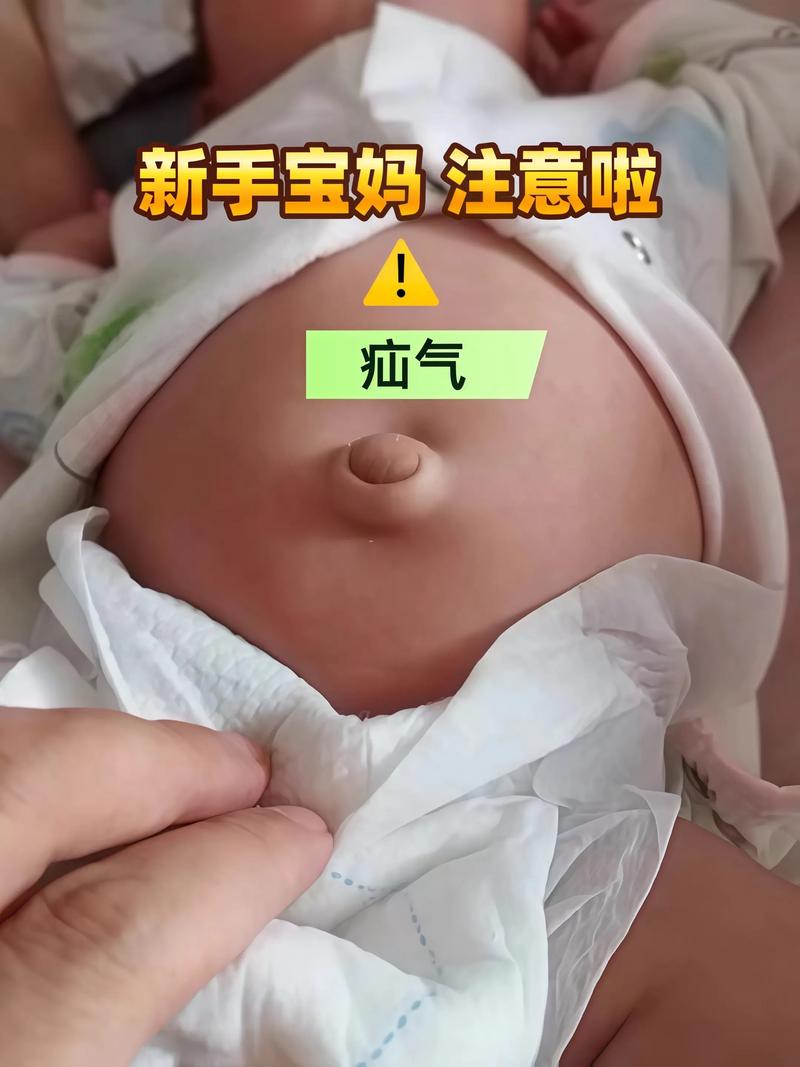 新生儿肚脐眼到底能不能碰水?日常护理该注意哪些细节?-第1张图片-郑州医学网 新生儿肚脐眼到底能不能碰水?日常护理该注意哪些细节?-第1张图片-郑州医学网