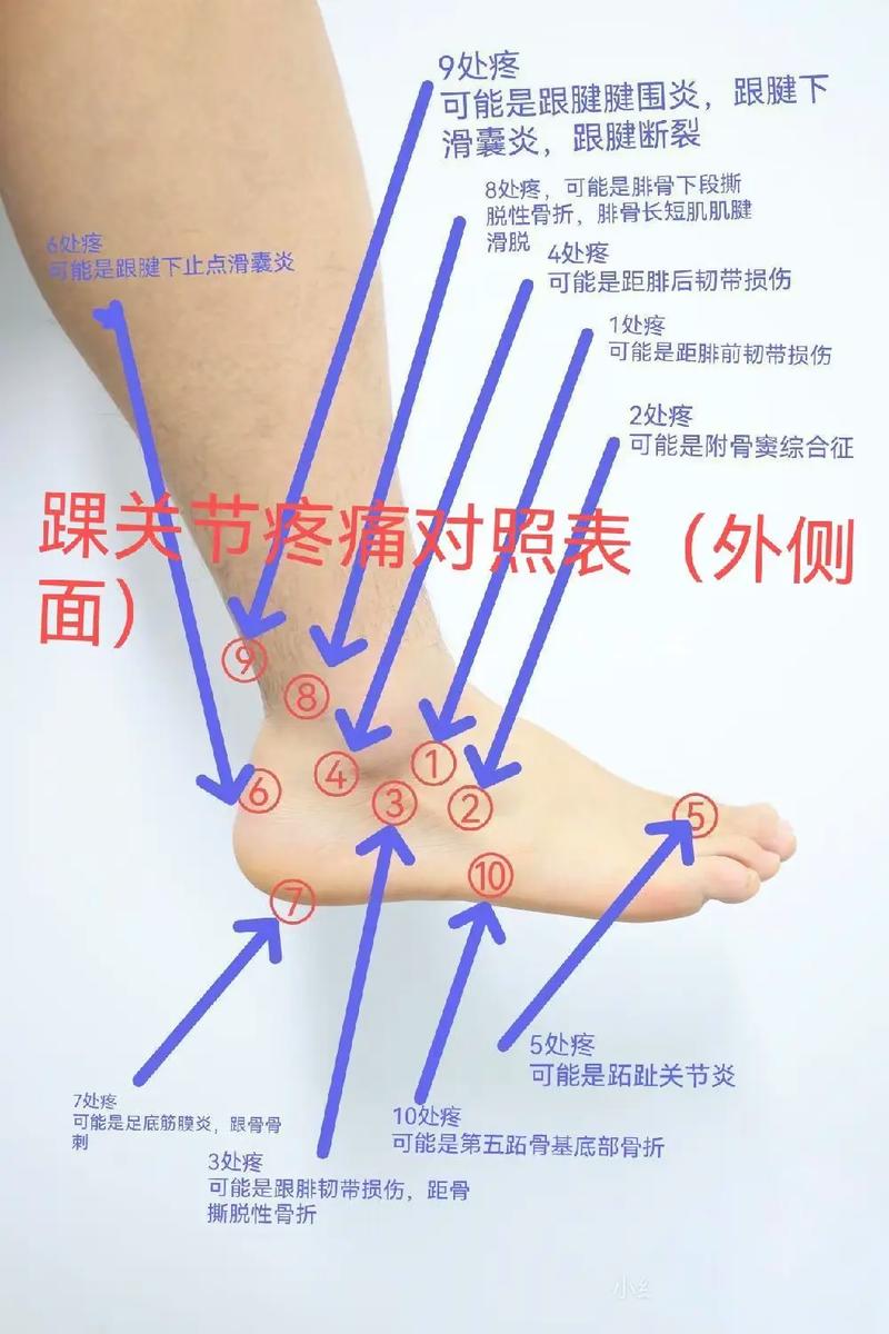 儿童脚关节痛是生长痛还是疾病信号？需警惕哪些潜在原因？-第2张图片-郑州医学网