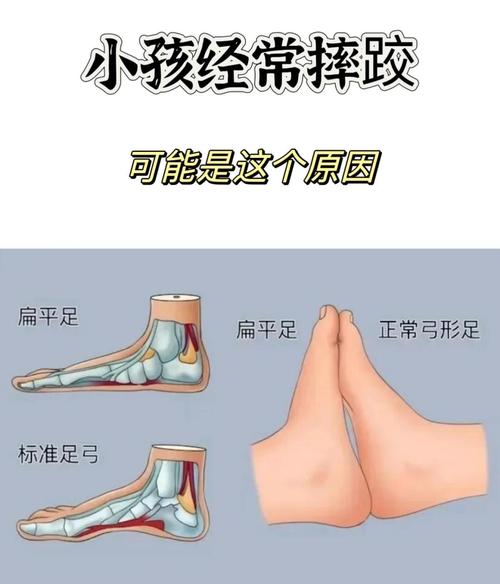 儿童脚关节痛是生长痛还是疾病信号？需警惕哪些潜在原因？-第3张图片-郑州医学网