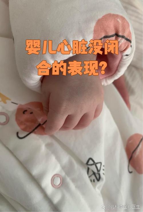 新生儿先天性心脏病有哪些容易被忽视的早期症状？-第2张图片-郑州医学网