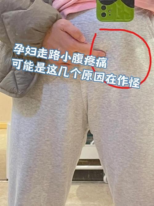 孕期肚脐眼周围皮肤疼，是正常现象还是需要警惕的异常信号？-第3张图片-郑州医学网