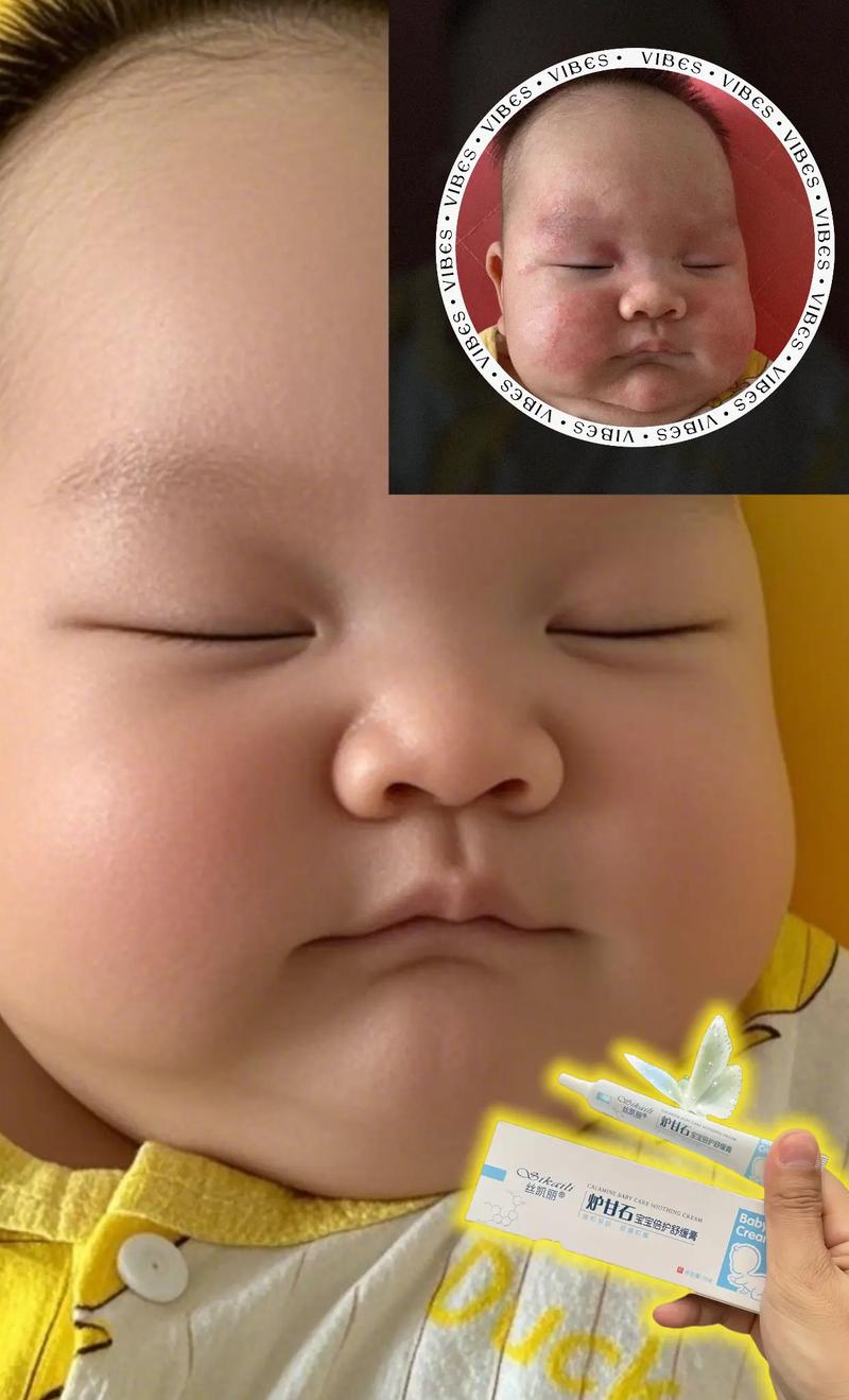 新生儿脸上有小红点点-第2张图片-郑州医学网 新生儿脸上有小红点点-第2张图片-郑州医学网