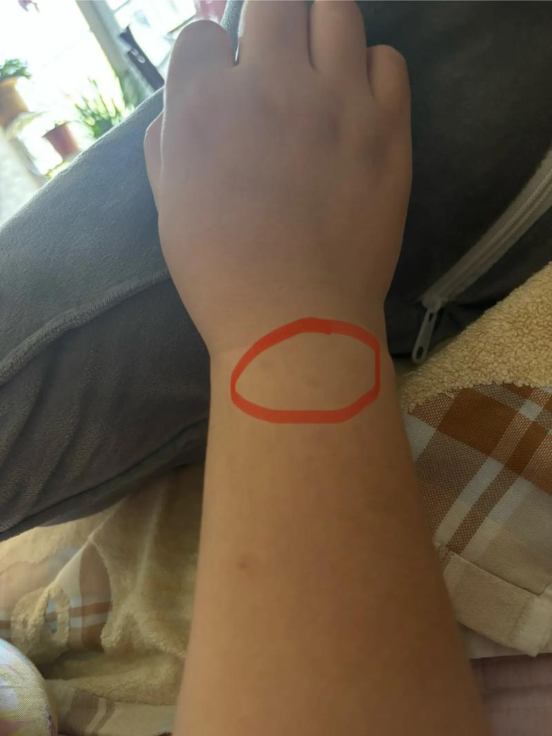 孕期手腕手指关节疼是缺钙还是激素变化？该怎么缓解才安全？-第1张图片-郑州医学网