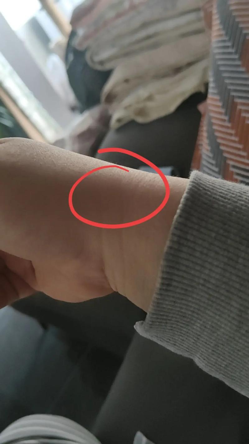 孕期手腕手指关节疼是缺钙还是激素变化？该怎么缓解才安全？-第2张图片-郑州医学网