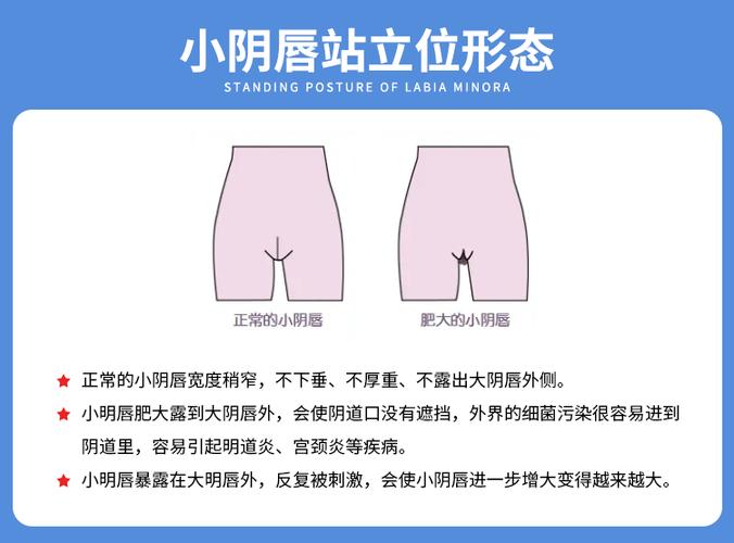 新生儿阴唇两侧有白色分泌物,是正常现象还是需要警惕的异常信号?-第2张图片-郑州医学网 新生儿阴唇两侧有白色分泌物,是正常现象还是需要警惕的异常信号?-第2张图片-郑州医学网