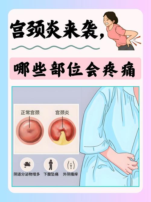 孕期为何易患妇科病?激素变化与免疫力下降如何交织影响?-第2张图片-郑州医学网 孕期为何易患妇科病?激素变化与免疫力下降如何交织影响?-第2张图片-郑州医学网