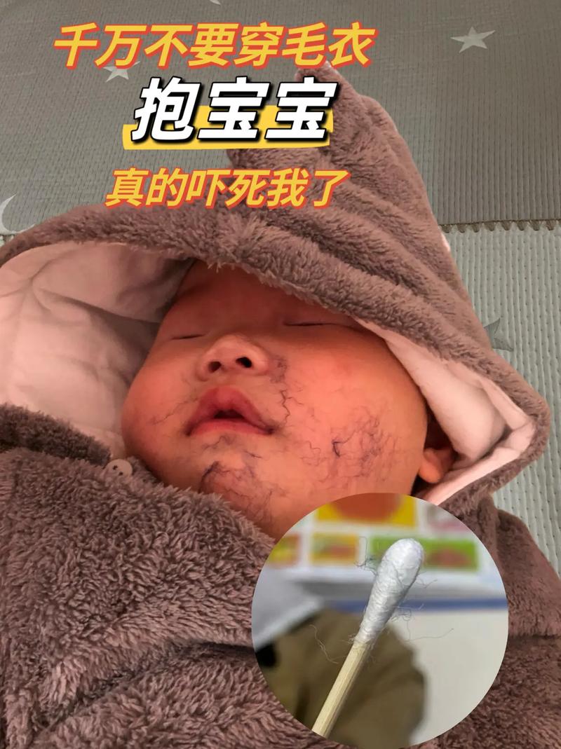 新生儿一醒就哭得厉害，是身体不舒服还是习惯没养好？-第2张图片-郑州医学网