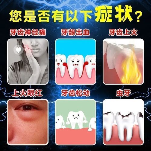 5岁儿童服用二丁颗粒的用量是多少?需要注意哪些事项?-第2张图片-郑州医学网 5岁儿童服用二丁颗粒的用量是多少?需要注意哪些事项?-第2张图片-郑州医学网