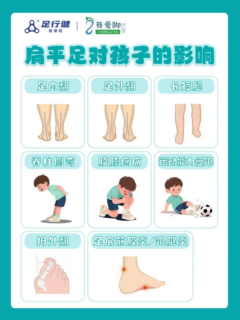新生儿足内翻能自行恢复吗？需要治疗吗？会影响走路吗？-第3张图片-郑州医学网
