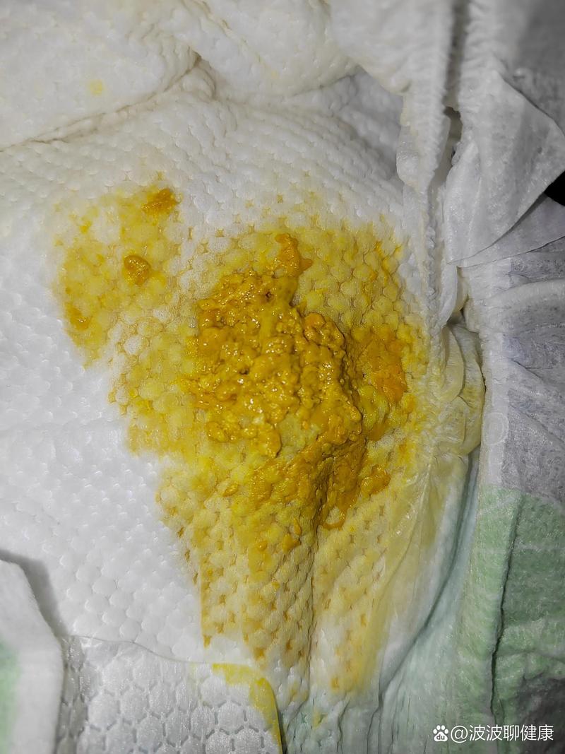 新生儿母乳喂养大便少，是消化不良还是正常现象？-第2张图片-郑州医学网