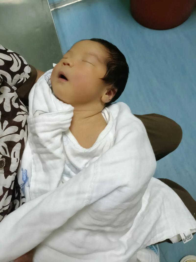 新生儿第六天黄疸16mg/dl需要立即干预吗？对宝宝有影响吗？-第1张图片-郑州医学网