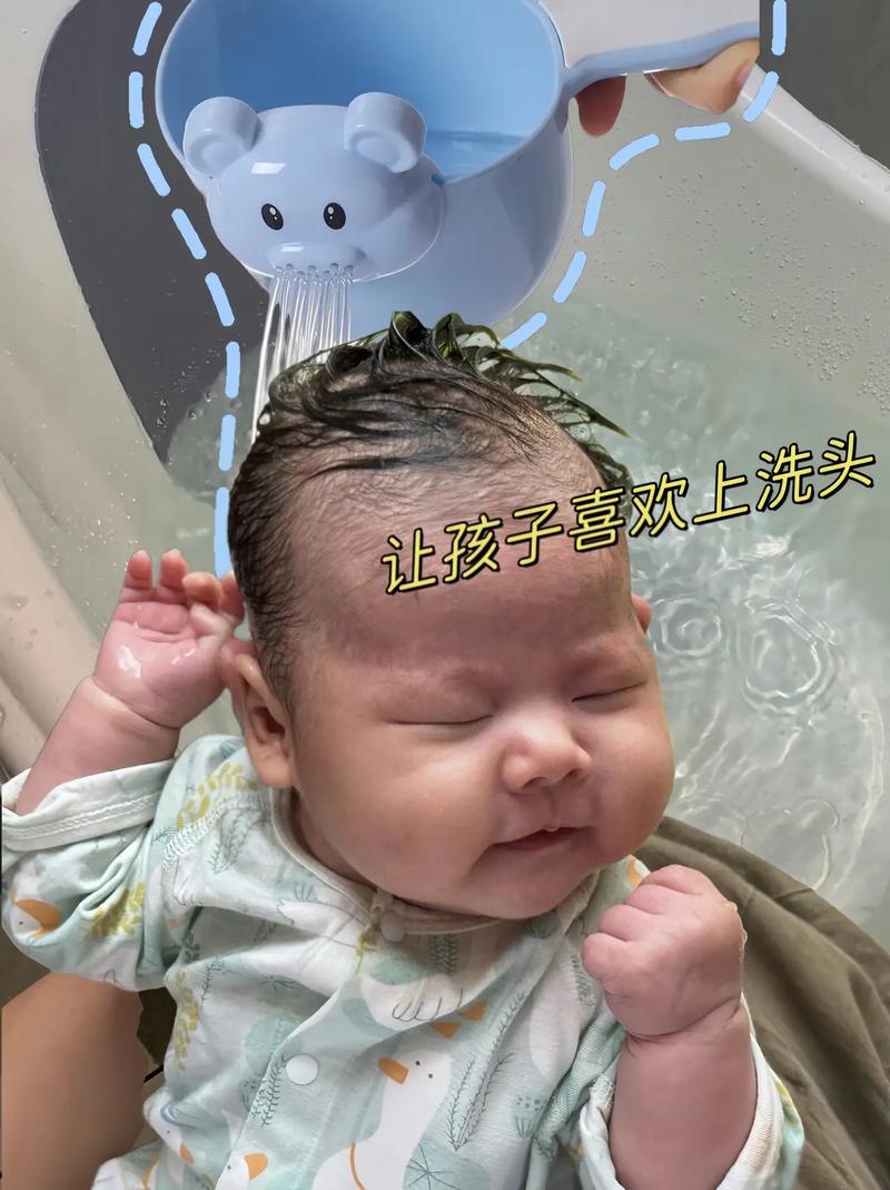 新生儿几天洗一次头发才合适？过度清洁或清洁不足会伤害头皮吗？-第3张图片-郑州医学网