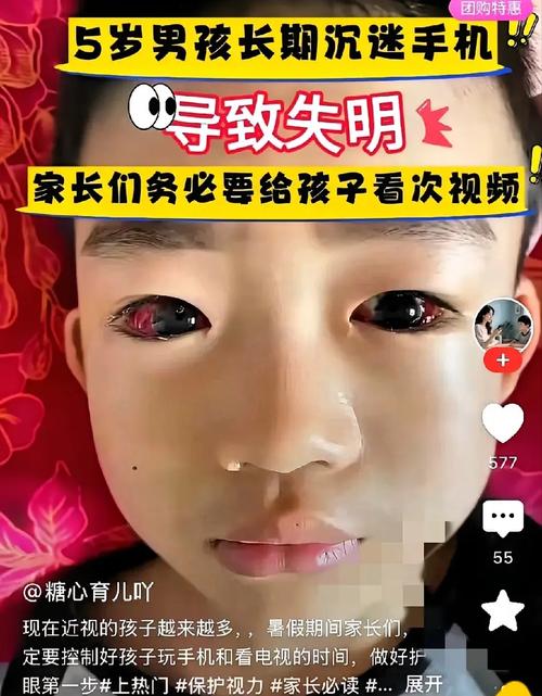 儿童看投影仪真的比看电视更护眼吗？距离、亮度与时长该如何把控？-第2张图片-郑州医学网