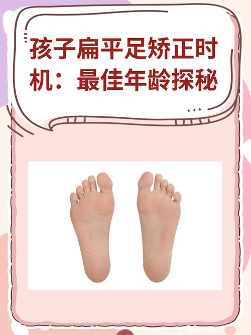 儿童扁平足矫正有哪些科学方法？不同年龄段矫正方案有何差异？-第3张图片-郑州医学网
