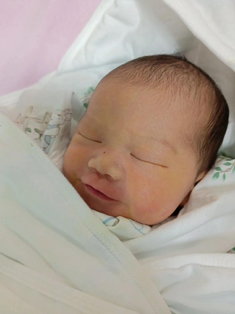 新生儿第三天黄疸18mg/dL需要立即干预吗？会对宝宝脑部发育有影响吗？-第2张图片-郑州医学网