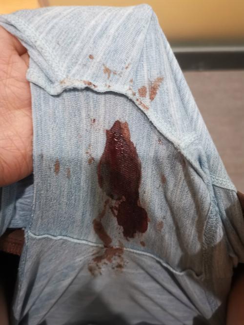 孕期出血伴随肚子咕噜响,是宝宝求救信号还是正常反应?-第1张图片-郑州医学网 孕期出血伴随肚子咕噜响,是宝宝求救信号还是正常反应?-第1张图片-郑州医学网