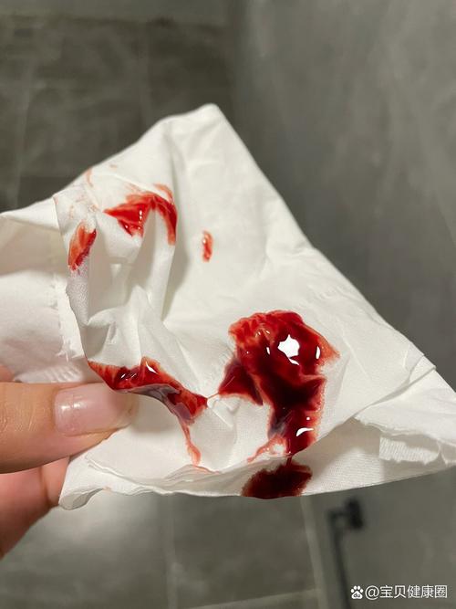 孕期出血伴随肚子咕噜响，是宝宝求救信号还是正常反应？-第3张图片-郑州医学网