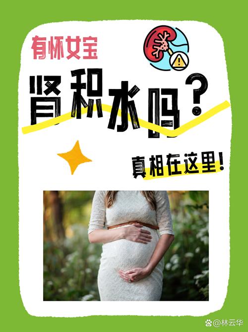 孕期积液会自行流出吗？对胎儿有影响吗？需要怎么处理？-第3张图片-郑州医学网
